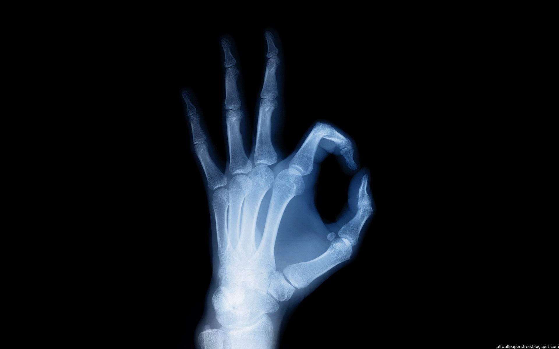x-rays, texture, background, download photo, arm x-ray texture background
