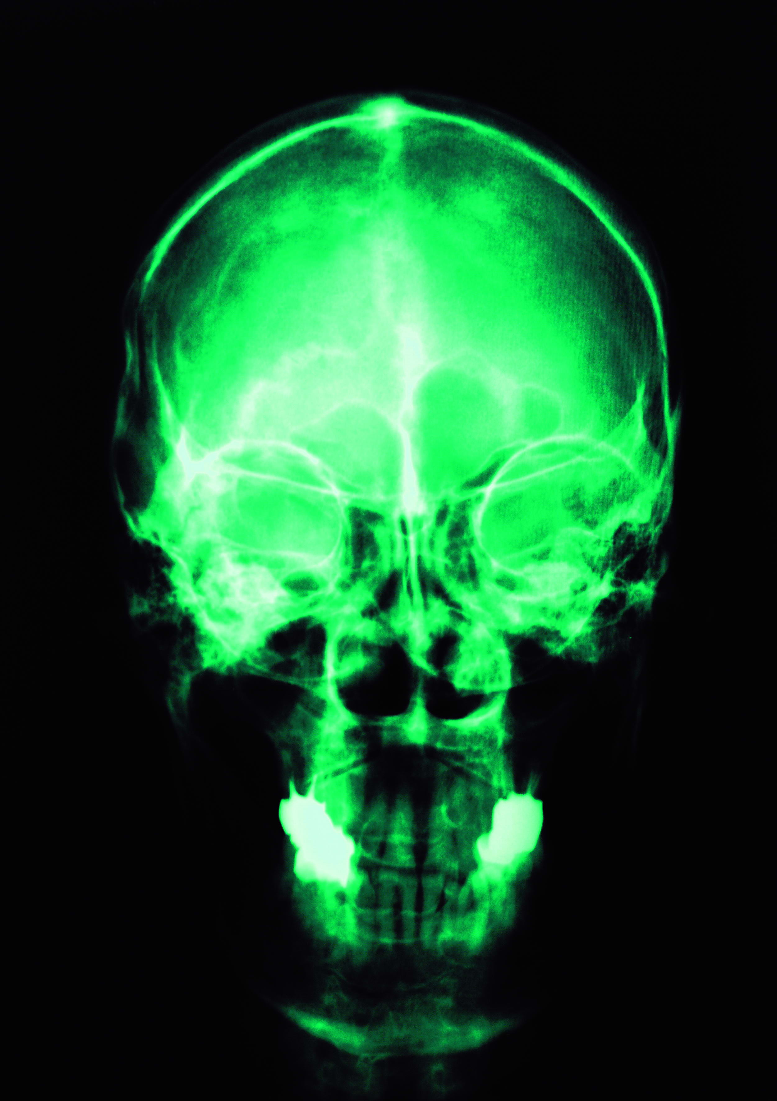 skull x-rays, texture, background, download photo, head skull x-ray texture background