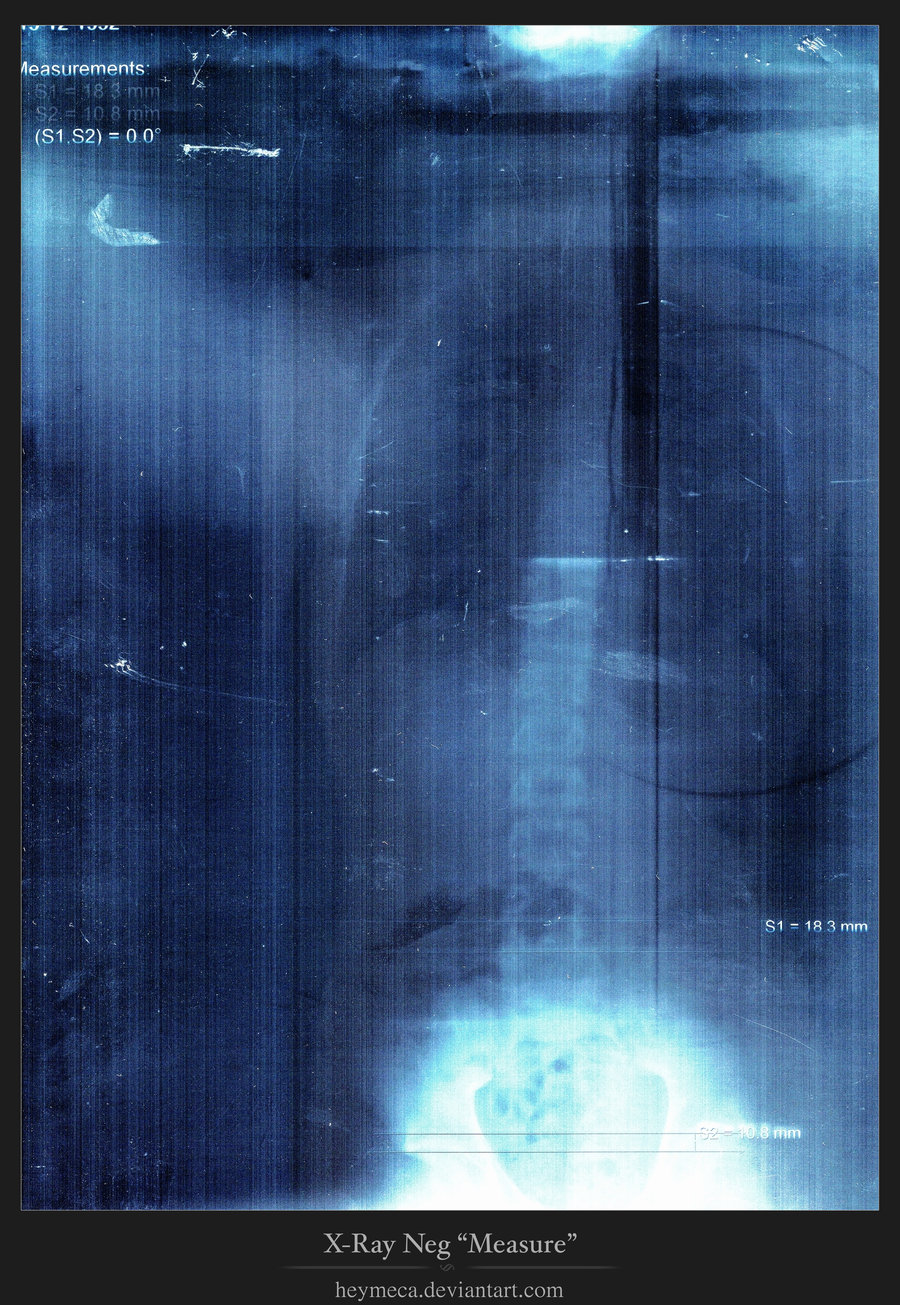 x-rays, texture, background, download photo, x-ray texture background